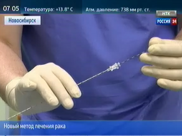 Новосибирские врачи теперь могут помочь больным раком предстательной железы