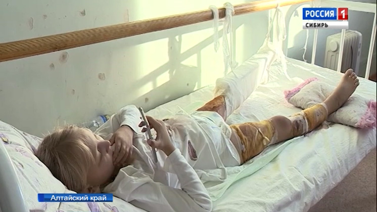 Барнаульские врачи спасают маленькую девочку, получившую ожоги в яме с кипятком
