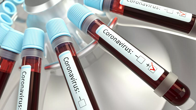 Ещё 256 новосибирцев заразились коронавирусом