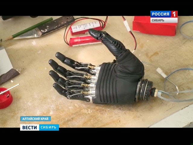 Барнаулец получил уникальный протез нового поколения - бионическую кисть