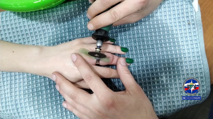 Спасатели Новосибирска сняли кольца с опухших пальцев двух женщин