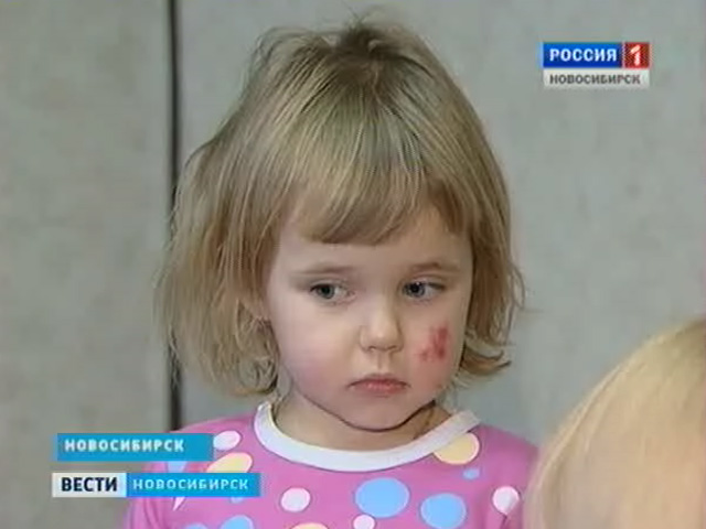 В новосибирском супермаркете маленькая девочка получила химические ожоги