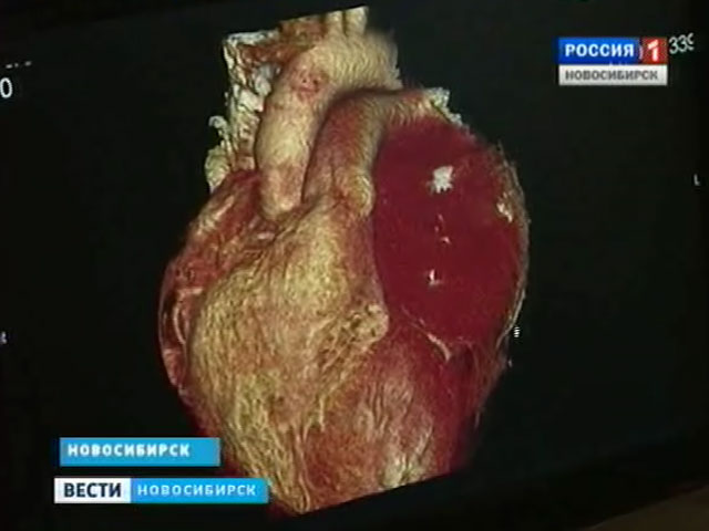 Новосибирские кардиохирурги спасли жизнь кемеровчанке с редкой сосудистой патологией