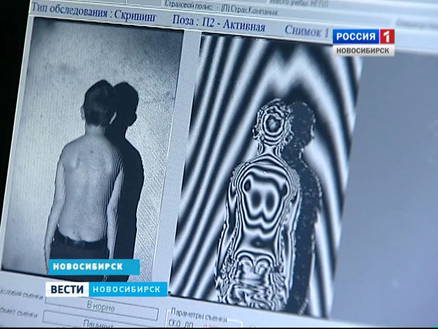 В Новосибирске массово обследуют школьников на заболевания позвоночника