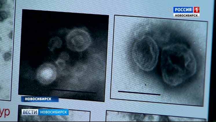 Новосибирские ученые получили 15 млн рублей на исследование нанопузырьков в организме животных и человека