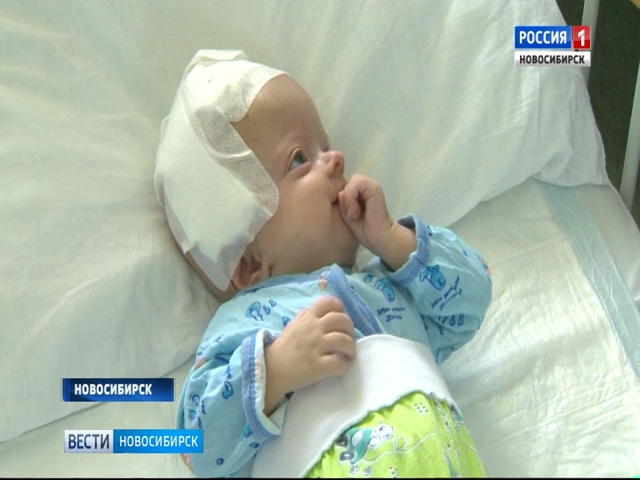 Новосибирские врачи спасли младенца с патологией костей черепа