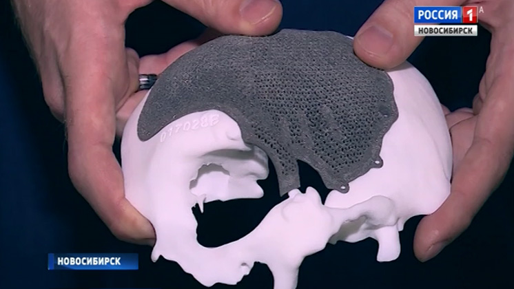 Новосибирский студент разработал программу для операций на черепе