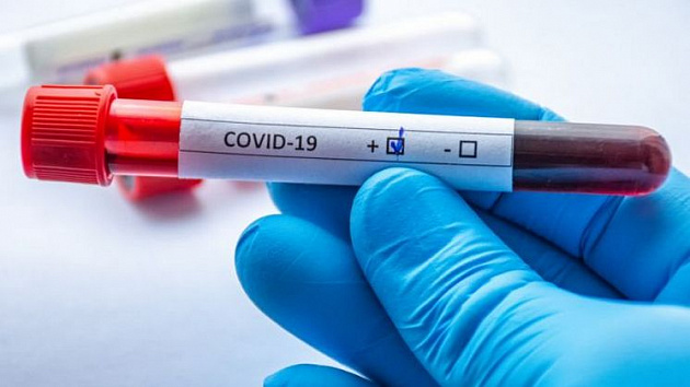 Ещё 171 новосибирец заразился коронавирусом