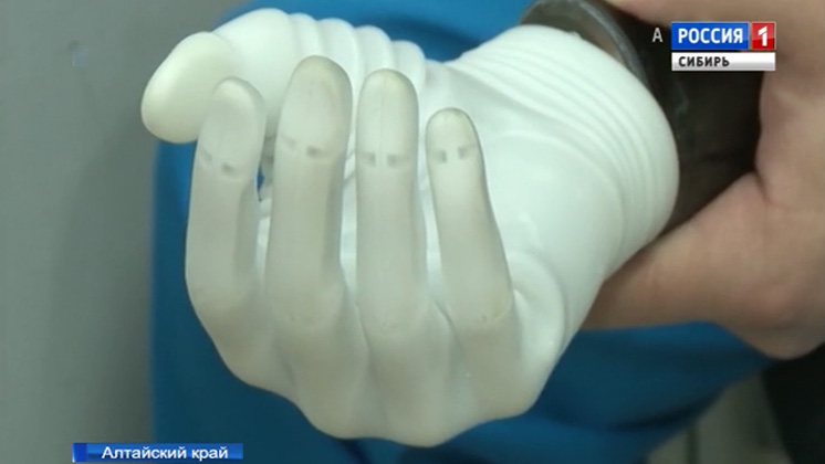 Барнаульские ортопеды готовят к установке новейший бионический протез «Микеланджело»