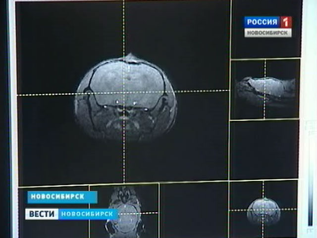 Новосибирские ученые открыли новый способ адресной доставки лекарства в мозг человека