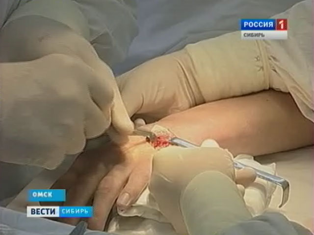 Омские ортопеды начали делать операции по исправлению сложных переломов кистей рук