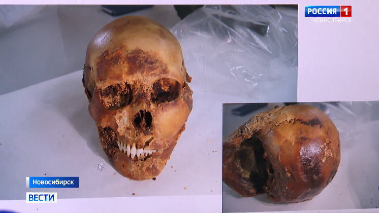 Новосибирские учёные раскрыли тайну древней хирургической операции