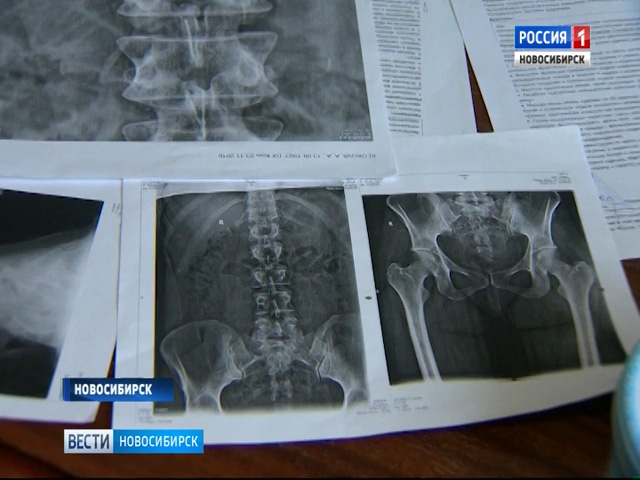 Жительница Новосибирска сломала позвоночник, поскользнувшись на ступенях своего подъезда
