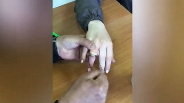 Новосибирские спасатели освободили опухший палец девушки от обручального кольца