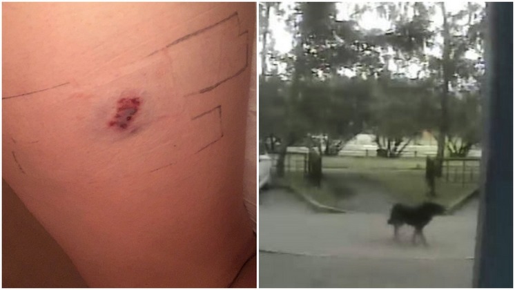 В Новосибирске агрессивный пес на улице накинулся на женщину и укусил ее