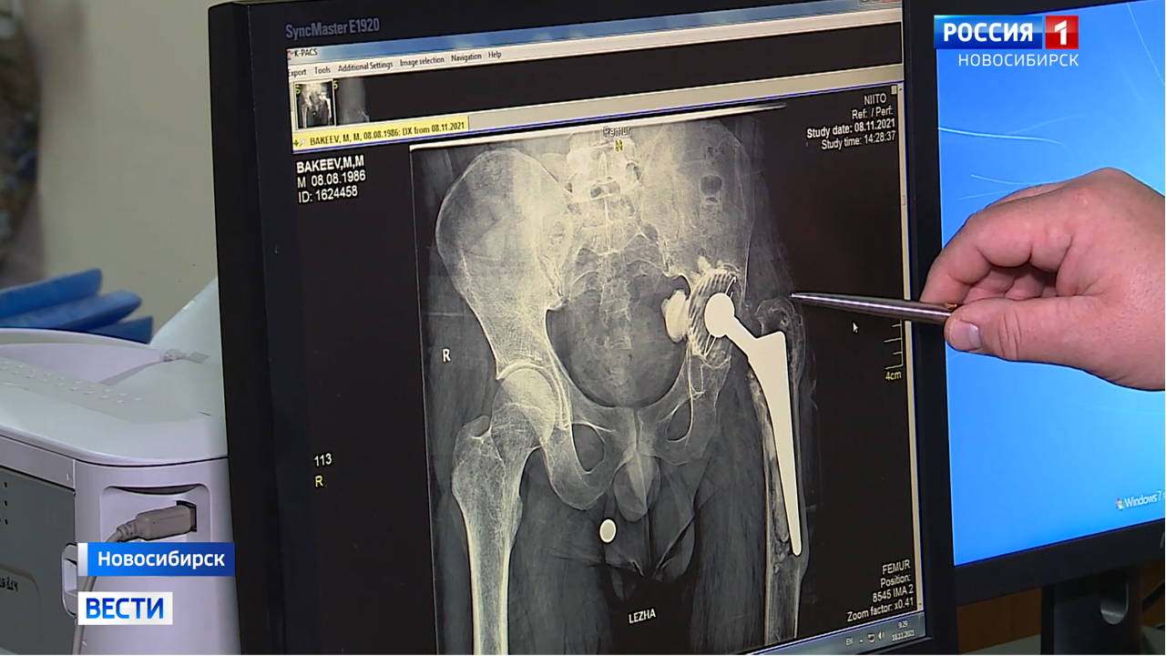 Врачу-травматологу из Киргизии провели сложную операцию коллеги из Новосибирска