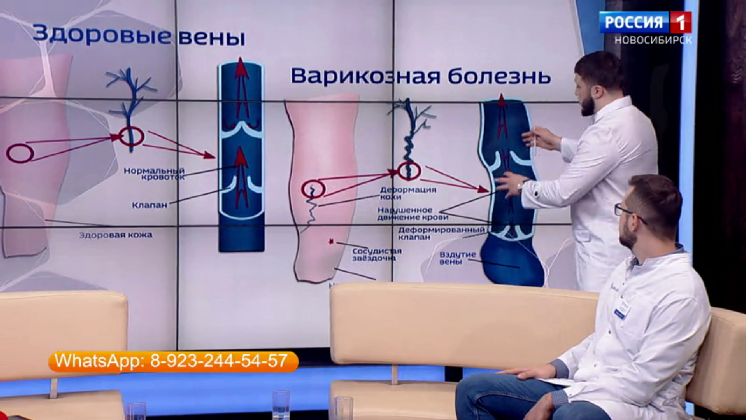 «Открытая школа здоровья» рассказала новосибирцам о профилактике варикоза