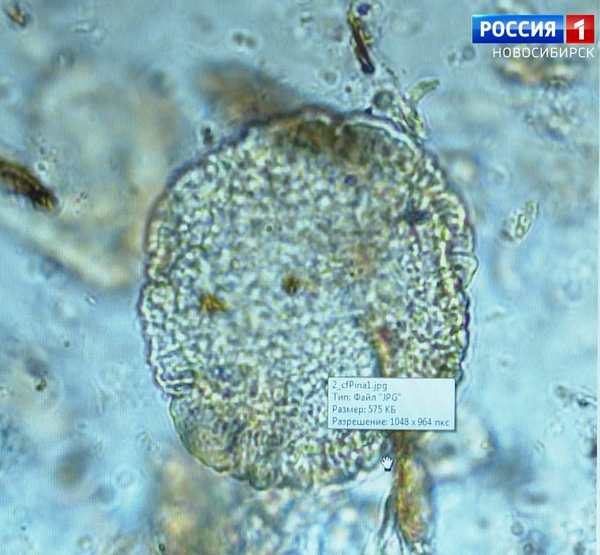 Пыльца под микроскопом