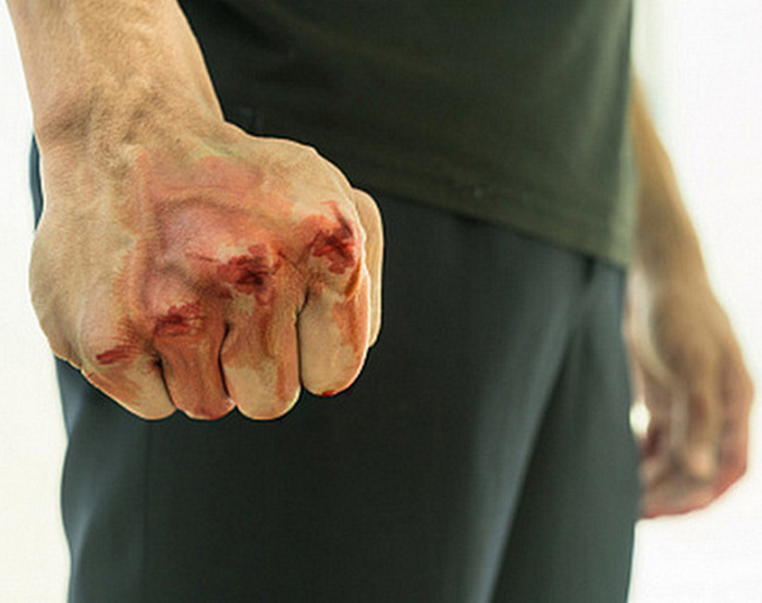 Кулак в крови