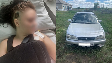 В Новосибирске врачи борются за жизнь 16-летней девочки, которую на машине переехал знакомый