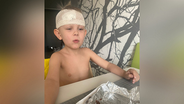 Пятилетнему мальчику наложили швы на лбу после инцидента в частном детсаду Новосибирска