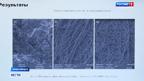 ВЕСТИ Новосибирск