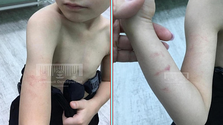 Новосибирские следователи проверят информацию об избиении ребёнка воспитателем в детсаду