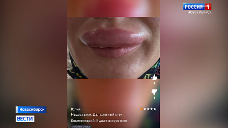 Жительницы Новосибирска в погоне за модой делают опасные уколы красоты