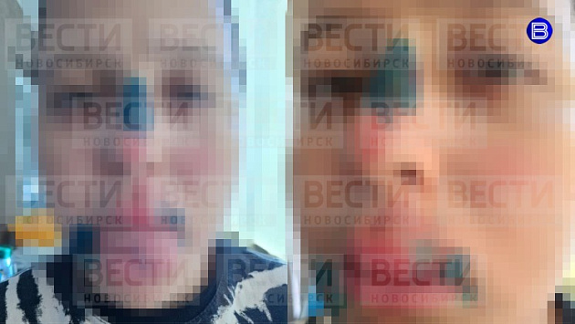 В Новосибирске железный трос порезал лицо ребенку во время прогулки