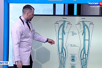 Открытая школа здоровья: как распознать опасный тромбоз
