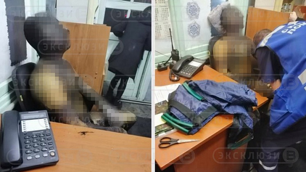 «Вести Новосибирск» публикуют эксклюзивные фото обожжённого рабочего Барабинской ТЭЦ