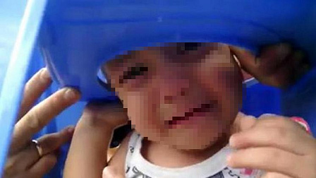 В Новосибирске голова двухлетнего ребенка застряла в сиденье горшка