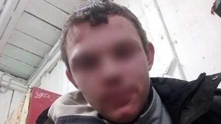 Полиция занялась 19-летним драчуном из села после материалов «Вести Новосибирск»