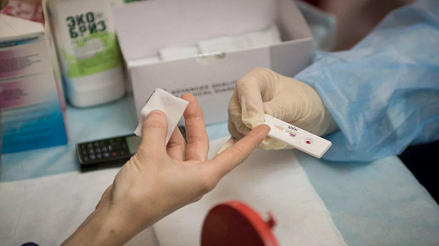 В Новосибирске назвали график проведения экспресс-тестов на ВИЧ в ноябре