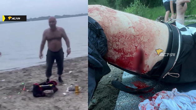 Сильный удар ножом получил отказавшийся покинуть место рыбалки новосибирец