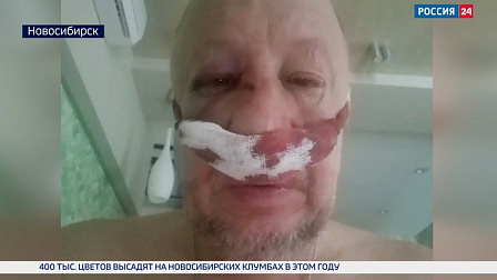 В Новосибирске снова подстрелили директора управляющей компании