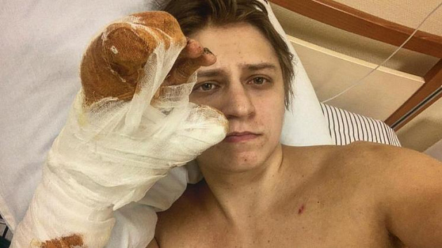 Популярный новосибирский блогер Mamix оказался в больнице после неудачного эксперимента