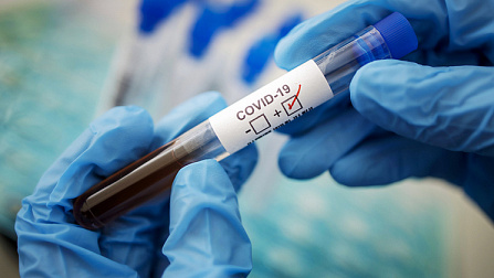 Ещё 315 случаев коронавируса выявили в Новосибирской области
