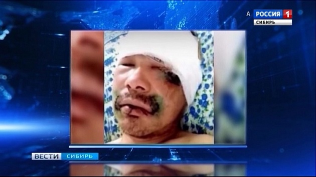 Тувинец укусил за язык медведя в лесу и выжил: мужчину оштрафуют